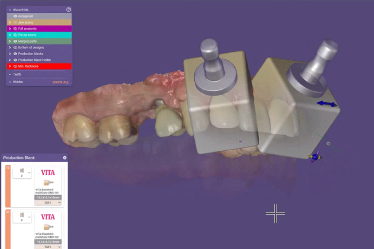 DentalCAD 3.2 Elefsina